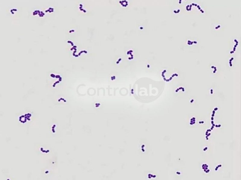 Bacterioscopia GRAM VET