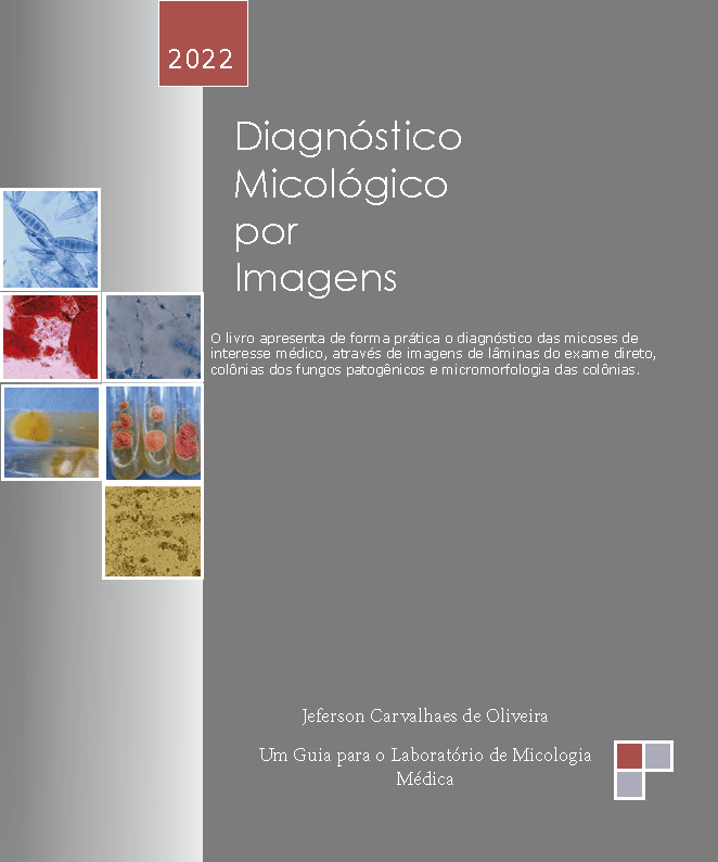 Diagnostico-Micologico-por-Imagens-final