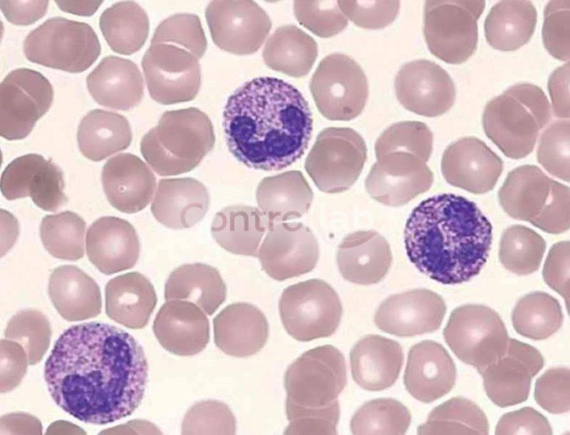 Hematoscopia