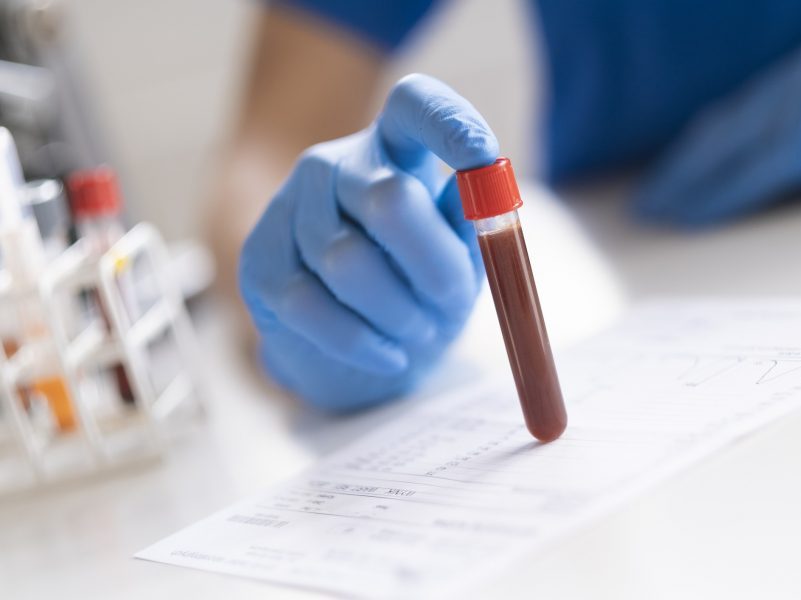 O diagnosticador está fazendo um teste de amostra de sangue.