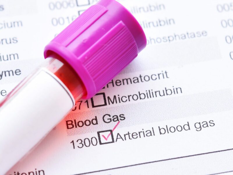 Tubo de amostra de sangue para teste de gasometria arterial