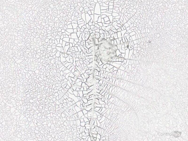 Ruptura Prematura das Membranas Teste de Fern