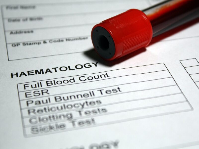 Teste de hematologia de sangue